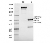 SDS-PAGE analysis of purified, BSA-free Albumin antibody (clone ALB/2144) as confirmation of integrity and purity.