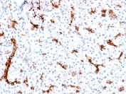 IHC staining of FFPE human pancreas with recombinant Gastric Mucin antibody (clone MUC6/1553R). Required HIER: boil tissue sections in pH 9 10mM Tris with 1mM EDTA for 10-20 min followed by cooling at RT for 20 min.