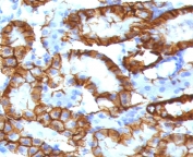 IHC testing of FFPE mouse kidney tissue with recombinant Cadherin 16 antibody (clone KSCP2-2R). Required HIER: steam sections in 10mM Tris with 1mM EDTA, pH9, for 10-20 min.