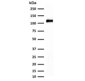Western blot testing of human kidney lysate with recombinant Cadherin 16 antibody (clone KSCP2-2R). Expected molecular weight: 90~130 kDa.~