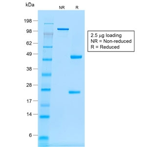SDS-PAGE analysis of purified, BSA-free recombinant CD20 antibody (clone rIGEL/773)