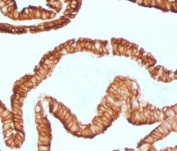 IHC staining of FFPE human oviduct with recombinant Cytokeratin 7 antibody (clone CTKN7-2R). Required HIER: boil tissue sections in pH6, 10mM citrate buffer, for 10-20 min followed by cooling at RT for 20 min.