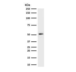 Western blot testing of human HeLa cell lysate with recombinant Cytokeratin 7 antibody (clone CTKN7-2R). Predicted molecular weight ~51 kDa.~