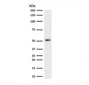 Western blot testing of human HeLa cell lysate with recombinant Cytokeratin 7 antibody (clone CTKN7-2R). Predicted molecular weight ~51 kDa.