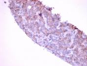 IHC testing of FFPE human bladder with EGF Receptor antibody (clone GFR/1667). HIER: boil tissue sections in pH 9 10mM Tris with 1mM EDTA for 20 min and allow to cool before testing.