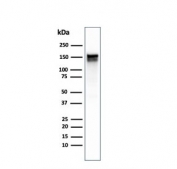 Western blot testing of A431 lysate using EGFR antibody (clone GFR/1667). Expected molecular weight: 134-180 kDa depending on glycosylation level.
