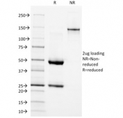 SDS-PAGE analysis of purified, BSA-free EGF Receptor antibody (clone GFR/1667) as confirmation of integrity and purity.