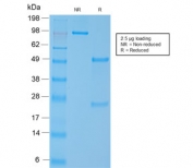 SDS-PAGE analysis of purified, BSA-free recombinant SMMHC antibody (clone MYH11/2303R) as confirmation of integrity and purity.