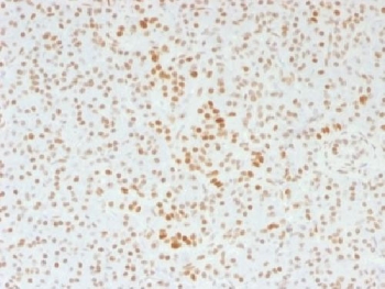 IHC testing of FFPE human pancreas with ATRX antibody (clone 39f). Required HIER: steam section in pH6 citrate buffer for 20 min and allow to cool prior to staining.~