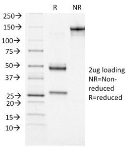 SDS-PAGE analysis of purified, BSA-free ATRX antibody (clone 39f) as c