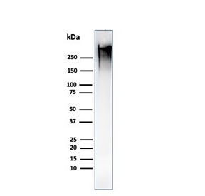 Western blot testing of human MCF7 cell lysate with recombinant Mucin-1 antibody (clone MUC1/1887R). This glycoprotein is commonly visualized between 120~500 kDa.~
