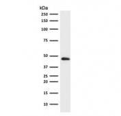 Western blot testing of human HepG2 antibody with Cytokeratin 19 antibody (clone CTKN19-2R). Predicted molecular weight ~43 kDa.