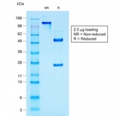 SDS-PAGE analysis of purified, BSA-free recombinant MUC-1 antibody (clone rMUC1/960) as confirmation of integrity and purity.