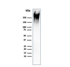 Western blot testing of human MCF7 cell lysate with recombinant MUC-1 antibody (clone rMUC1/960). This glycoprotein is commonly visualized between 120~500 kDa.~