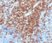 IHC staining of FFPE human tonsil tissue with recombinant CD43 antibody (clone CDLA43-2R). Required HIER: boil tissue sections in pH 9 10mM Tris with 1mM EDTA for 10-20 min followed by cooling at RT for 20 min.
