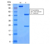 SDS-PAGE analysis of purified, BSA-free recombinant Cytokeratin 8/18 antibody (clone rKRT8.18/1346) as confirmation of integrity and purity.