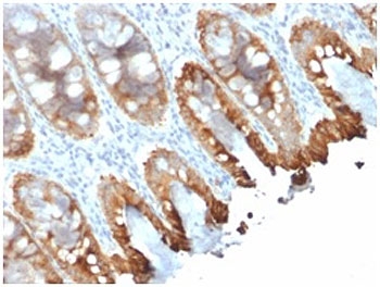 IHC staining of FFPE human colon tissue with recombinant Cytokeratin 8/18 antibody (clone rKRT8.18/1346). Required HIER: boil tissue sections in pH 9 10mM Tris with 1mM EDTA for 10-20 min and allow to cool before testing.~