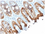 IHC staining of FFPE human colon tissue with recombinant Cytokeratin 8/18 antibody (clone rKRT8.18/1346). Required HIER: boil tissue sections in pH 9 10mM Tris with 1mM EDTA for 10-20 min and allow to cool before testing.