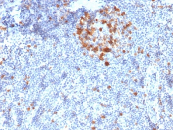 IHC staining of FFPE human tonsil with CDC2 antibody (clone A17.1.1). HIER: boil tissue sections in pH6, 10mM citrate buffer, for 10-20 min followed by cooling at RT for 20 min.~