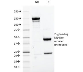 SDS-PAGE analysis of purified, BSA-free CDC2 antibody (clo