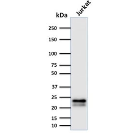 Western blot testing of human Jurkat cells with CD3e antibody (clone C3e/2478). Expected molecular weight ~23 kD