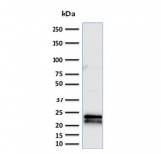 Western blot testing of human Jurkat cell lysate with CD3e antibody (clone C3e/2479). 