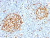 IHC testing of FFPE human lymph node with CD14 antibody (clone LPSR/2397). HIER: boil tissue sections in 10mM Tris with 1mM EDTA, pH 9, for 10-20 min followed by cooling at RT for 20 min.