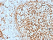 IHC testing of FFPE human tonsil with CD14 antibody (clone LPSR/2397). HIER: boil tissue sections in 10mM Tris with 1mM EDTA, pH 9, for 10-20 min followed by cooling at RT for 20 min.