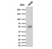 Western blot testing of human A549 cell lysate with CD14 antibody (clone LPSR/2397). Predicted molecular weight: 40-55 kDa depending on glycosylation level.