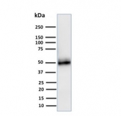 Western blot testing of human A549 cell lysate with CD14 antibody (clone LPSR/2408). Expected molecular weight 40-55 kDa depending on glycosylation level.