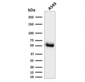 Western blot testing of human A549 cell lysate with CD14 antibody (clone LPSR/2385). Predicted molecular weight: 40-55 kDa depending on glycosylation level.