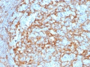 IHC testing of FFPE human lymph node with CD14 antibody (clone LPSR/2385). HIER: boil tissue sections in pH 9 10mM Tris with 1mM EDTA for 10-20 min followed by cooling at RT for 20 min.