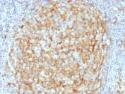 IHC testing of FFPE human lymph node tissue with CD14 antibody (clone LPSR/2386). HIER: boil tissue sections in 10mM Tris with 1mM EDTA, pH 9, for 10-20 min followed by cooling at RT for 20 min.