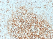 IHC testing of FFPE human tonsil with CD14 antibody (clone LPSR/2386). HIER: boil tissue sections in 10mM Tris with 1mM EDTA, pH 9, for 10-20 min followed by cooling at RT for 20 min.