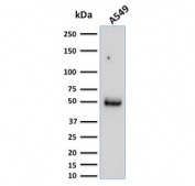 Western blot testing of human A549 cell lysate with CD14 antibody (clone LPSR/2386). Expected molecular weight: 40-55 kDa depending on glycosylation level.