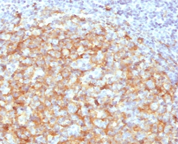 IHC testing of FFPE human lymph node with CD14 antibody (clone CDLA14-2). HIER: boil tissue sections in 10mM Tris with 1mM EDTA, pH 9, for 10-20 min followed by cooling at RT for 20 min.~