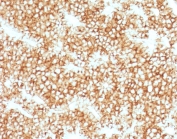 IHC testing of FFPE human parathyroid gland stained with recombinant Parathyroid Hormone antibody (clone PRTM1-1R). Required HIER: steam sections in pH 9 10mM Tris with 1mM EDTA for 10-20 min.