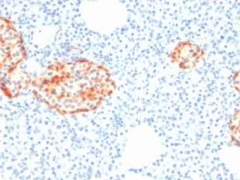 IHC staining of FFPE human pancreas with recombinant Chromogranin A antibody (clone rCHGA/798). HIER: boil tissue sections in pH6, 10mM citrate buffer, for 10-20 min followed by cooling at RT for 20 min.~