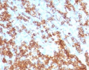 IHC staining of FFPE human tonsil tissue with recombinant CD45RB antibody (clone CDLA45RB-2R). Required HIER: boil tissue sections in 10mM citrate buffer, pH 6, for 10-20 min followed by cooling at RT for 20 min.