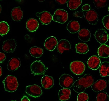 Immunofluorescence staining of PFA-fixed human Raji cells with CD45RB antibody (clone CDLA45RB-2R, green) and Phalloidin (red).~