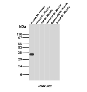 Calponin 1 Antibody Multi-Species Skeletal Muscle WB. Western blot analysis of human skeletal muscle lysate, mouse skeletal muscle lysate, rat skeletal muscle lysate, hamster skeletal muscle lysate, guinea pig skeletal muscle lysate, and rabbit skeletal muscle lysate using Calponin 1 antibody (clone rCNN1/832). A band is detected at approximately 34 kDa, consistent with the predicted molecular weight of Calponin 1 / CNN1. Signal is observed in human skeletal muscle, while other species show minimal detection, reflecting the expected expression pattern of this smooth muscle-associated contractile protein.
