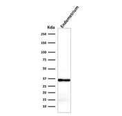 Calponin Antibody Endometrium WB. Western blot analysis of human endometrium tissue lysate using Calponin antibody, clone rCNN1/832. A band is detected at approximately 34 kDa, consistent with the predicted molecular weight of Calponin 1 / CNN1. Signal in endometrial tissue reflects the presence of smooth muscle-associated cells within the stromal compartment, supporting its role as a contractile protein marker.