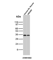 Calponin Antibody Skeletal Muscle and HEK293 WB. Western blot analysis of human skeletal muscle lysate and HEK293 cell lysate using Calponin antibody, clone rCNN1/832. A band is detected at approximately 34 kDa, consistent with the predicted molecular weight of Calponin 1 / CNN1. Signal in skeletal muscle aligns with expression in contractile tissue, while detection in HEK293 cells reflects basal expression of this actin-associated protein in cultured cells.
