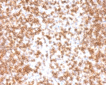 IHC staining of FFPE human tonsil tissue with recombinant CD45 antibody (clone CDLA45-3R). Required HIER: boil tissue sections in 10mM citrate buffer, pH 6, for 10-20 min followed by cooling at RT for 20 min.~