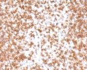 IHC staining of FFPE human tonsil tissue with recombinant CD45 antibody (clone CDLA45-3R). Required HIER: boil tissue sections in 10mM citrate buffer, pH 6, for 10-20 min followed by cooling at RT for 20 min.