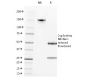 SDS-PAGE analysis of purified, BSA-free CD21 antibody (clone CR2/1952) as confirmation of integrity and purity.