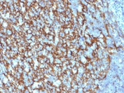 IHC testing of FFPE human tonsil tissue with CD21 antibody (clone CR2/1952). HIER: boil tissue sections in pH6, 10mM citrate buffer, for 10-20 min followed by cooling at RT for 20 min.