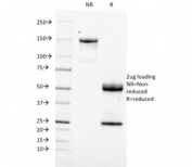 SDS-PAGE analysis of purified, BSA-free CD21 antibody (clone CR2/1953) as confirmation of integrity and purity.