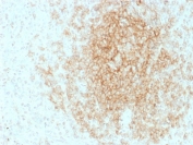 IHC testing of FFPE human tonsil tissue with CD21 antibody (clone CR2/1953). HIER: boil tissue sections in pH6, 10mM citrate buffer, for 10-20 min followed by cooling at RT for 20 min.