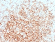 IHC testing of FFPE human tonsil tissue with CD21 antibody (clone CDLA21-1). HIER: boil tissue sections in pH6, 10mM citrate buffer, for 10-20 min followed by cooling at RT for 20 min.